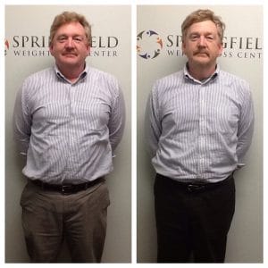 Springfield IL Weight Loss Before and After Springfield Weight Loss Center