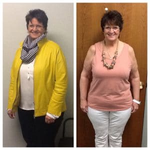 Springfield IL Weight Loss Before and After Springfield Weight Loss Center