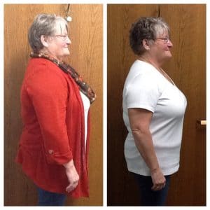 Springfield IL Weight Loss Before and After Springfield Weight Loss Center