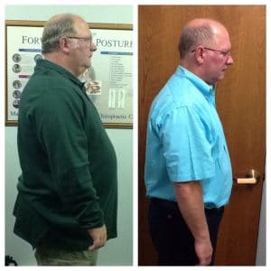 Springfield IL Weight Loss Before and After Springfield Weight Loss Center