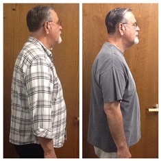 Springfield IL Weight Loss Before and After Springfield Weight Loss Center