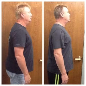 Springfield IL Weight Loss Before and After Springfield Weight Loss Center