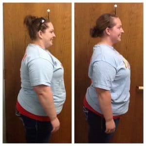 Springfield IL Weight Loss Before and After Springfield Weight Loss Center