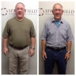 Springfield IL Weight Loss Before and After Springfield Weight Loss Center