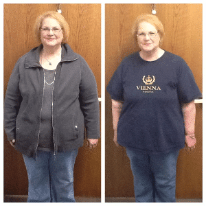 Springfield IL Weight Loss Before and After Springfield Weight Loss Center