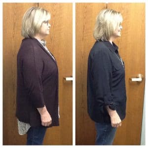 Springfield IL Weight Loss Before and After Springfield Weight Loss Center