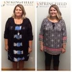 Springfield IL Weight Loss Before and After Springfield Weight Loss Center