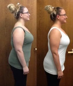 Springfield IL Weight Loss Before and After Springfield Weight Loss Center