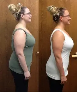 Springfield IL Weight Loss Before and After Springfield Weight Loss Center