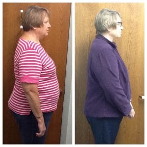 Springfield IL Weight Loss Before and After Springfield Weight Loss Center