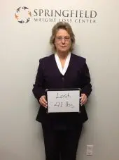 Springfield IL Weight Loss Before and After Springfield Weight Loss Center