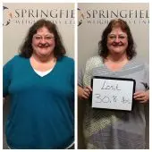 Springfield IL Weight Loss Before and After Springfield Weight Loss Center