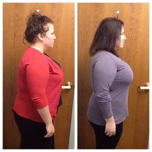 Springfield IL Weight Loss Before and After Springfield Weight Loss Center