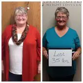 Springfield IL Weight Loss Before and After Springfield Weight Loss Center