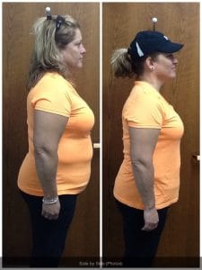 Springfield IL Weight Loss Before and After Springfield Weight Loss Center