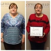 Springfield IL Weight Loss Before and After Springfield Weight Loss Center