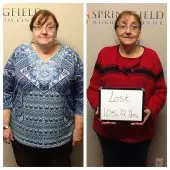 Springfield IL Weight Loss Before and After Springfield Weight Loss Center