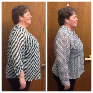 Springfield IL Weight Loss Before and After Springfield Weight Loss Center