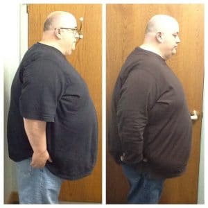 Springfield IL Weight Loss Before and After Springfield Weight Loss Center