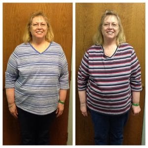 Springfield IL Weight Loss Before and After Springfield Weight Loss Center