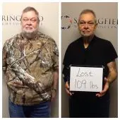 Springfield IL Weight Loss Before and After Springfield Weight Loss Center