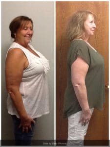 Springfield IL Weight Loss Before and After Springfield Weight Loss Center