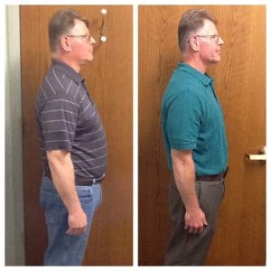 Springfield IL Weight Loss Before and After Springfield Weight Loss Center