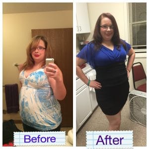 Springfield IL Weight Loss Before and After Springfield Weight Loss Center