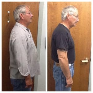 Springfield IL Weight Loss Before and After Springfield Weight Loss Center