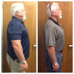 Springfield IL Weight Loss Before and After Springfield Weight Loss Center