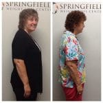 Springfield IL Weight Loss Before and After Springfield Weight Loss Center