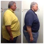 Springfield IL Weight Loss Before and After Springfield Weight Loss Center