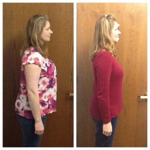 Springfield IL Weight Loss Before and After Springfield Weight Loss Center