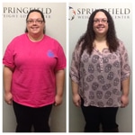 Springfield IL Weight Loss Before and After Springfield Weight Loss Center