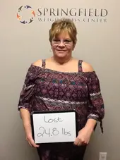 Springfield IL Weight Loss Before and After