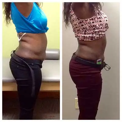 Weight-Loss-Before-and-After Weight Loss Before and After