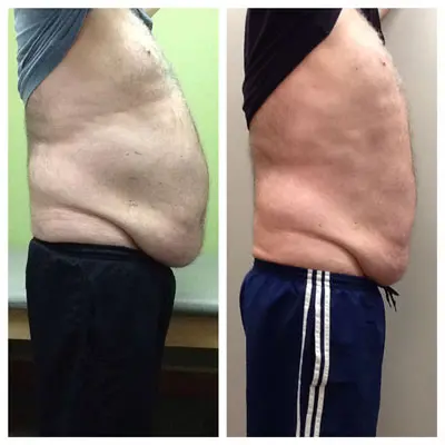 Before-and-After-Weight-Loss Weight Loss Before and After