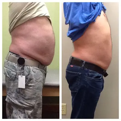 Weight-Loss-Before-and-After Weight Loss Before and After